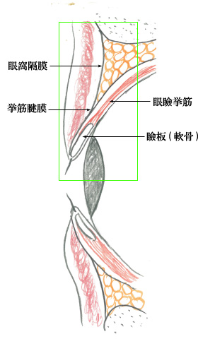 1 1