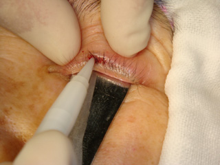 Fig_43